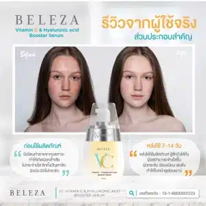 รีวิว-Beleza-VC-เบเลซ่า-วีซี-ลดริ้วรอย-ผิวหมองคล้ำ-