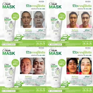 รีวิว Oclay Mask โอเคร มาส์ก ลดริ้วรอย รอยสิว 3